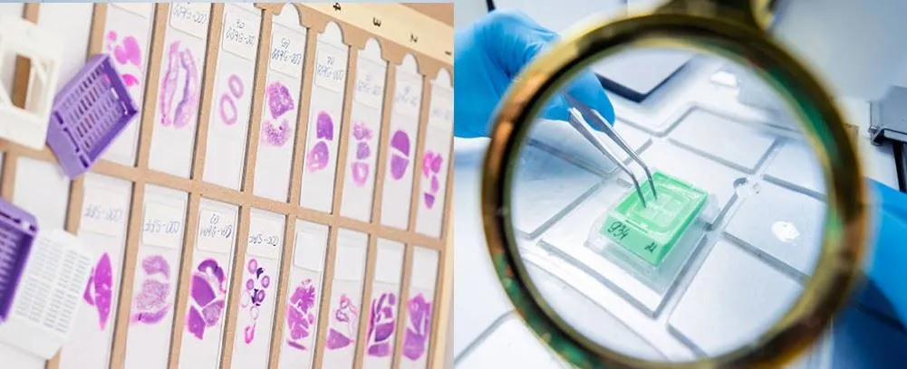 application of lab embedding cassette