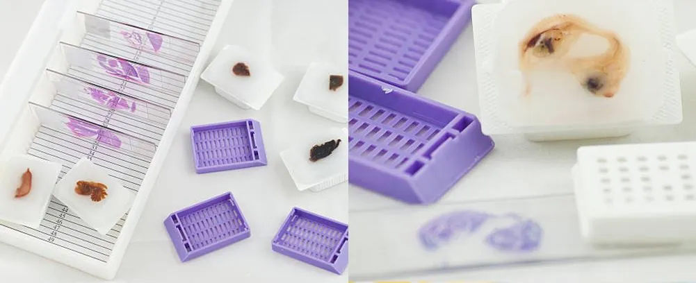 lab embedding cassette application